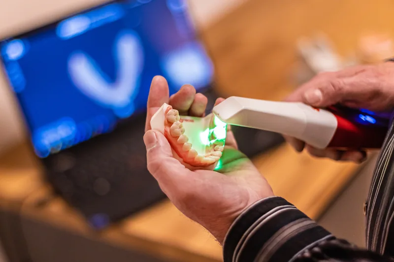 Praktische Demonstration eines Intraoralscanners an einem Zahnmodell